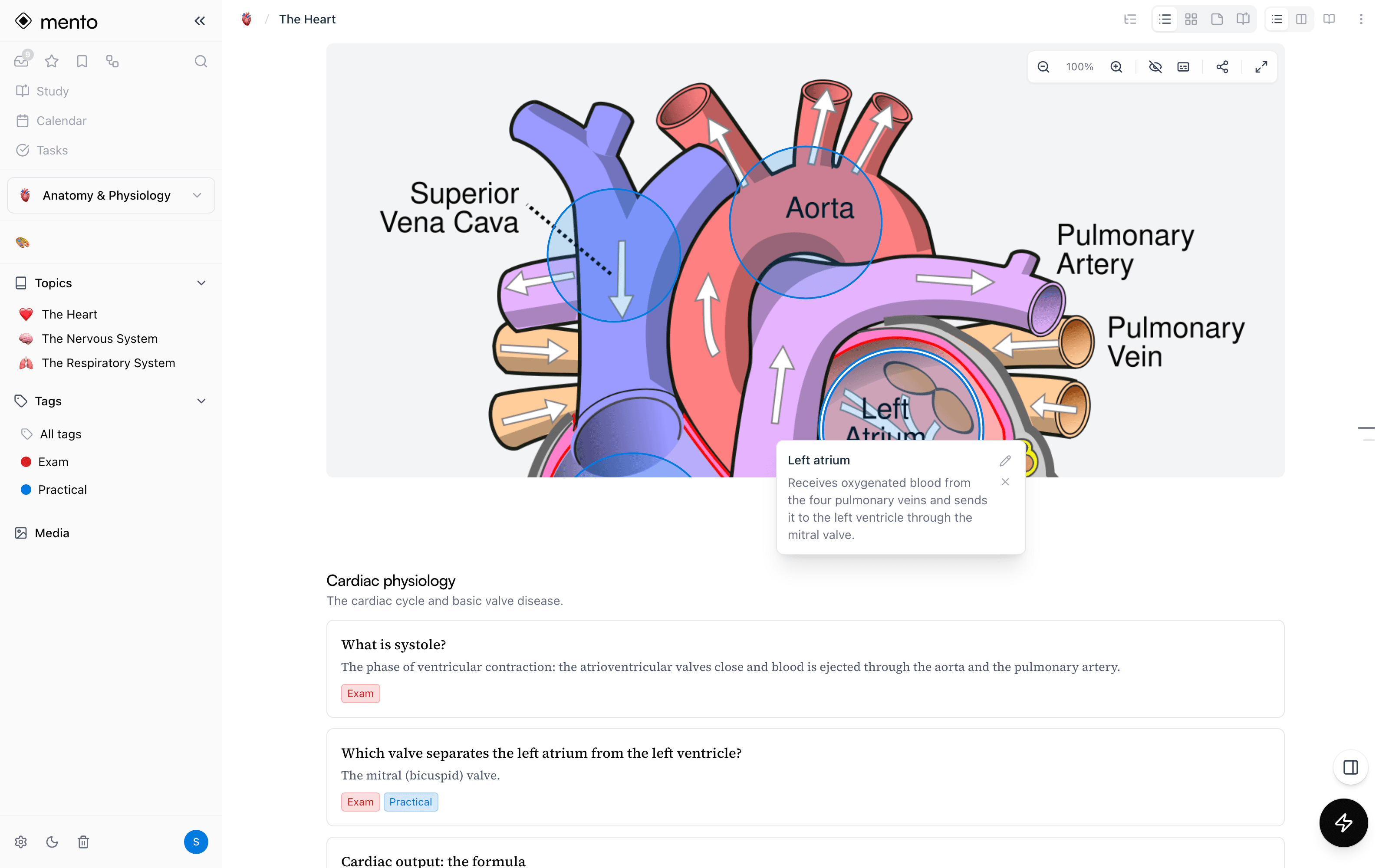 A labeled heart diagram in Mento with tappable hotspots and an open card about the left atrium