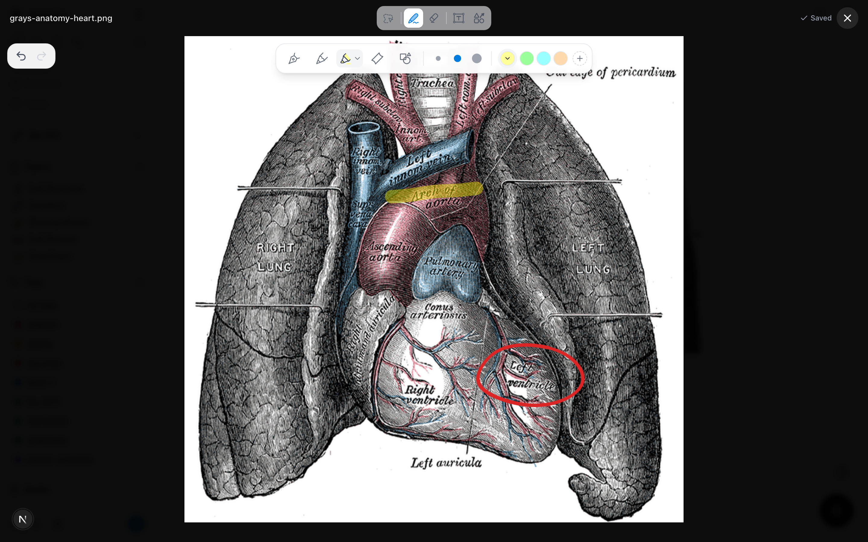 An anatomical diagram of the heart open for annotation, with the left ventricle circled in red pen and a label highlighted