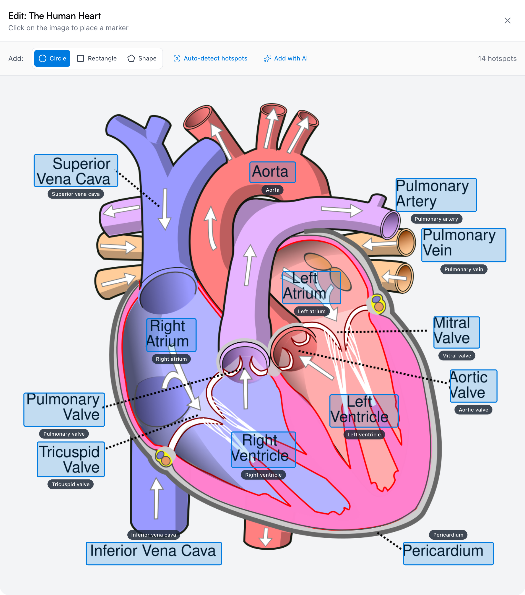The image map editor on a heart diagram — Circle, Rectangle, and Shape tools, the Auto-detect hotspots and Add with AI buttons, and 14 labeled hotspots